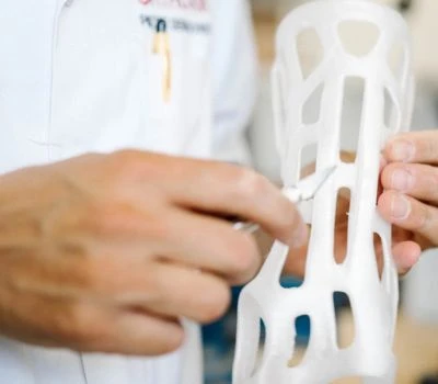 Exportació de formats de fitxers STL per a ortesis impreses en 3D: com l'escaneig de peus en 3D c...