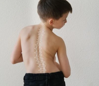 El temps de pantalla està remodelant la columna vertebral d'una generació?