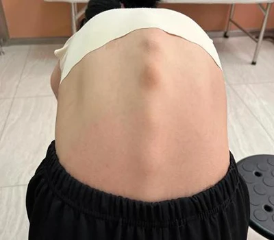 Revolucionant la salut de la columna vertebral: escàner corporal 3D Xianku
