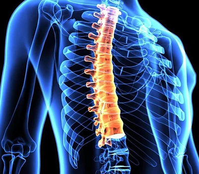 Correcció espinal: com Xianku3d Body Scanner està transformant la salut espinal