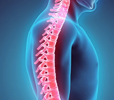 Correcció de la columna vertebral: solució de la columna vertebral digital-sense radiació